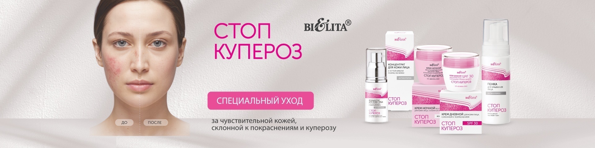 Стоп купероз