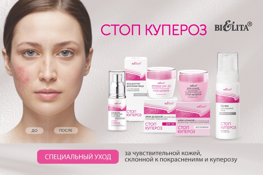 Стоп-купероз_Баннеры_838х559.jpg